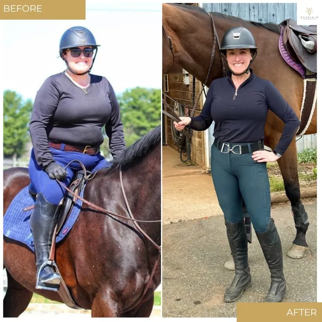 Weight Loss Before & After