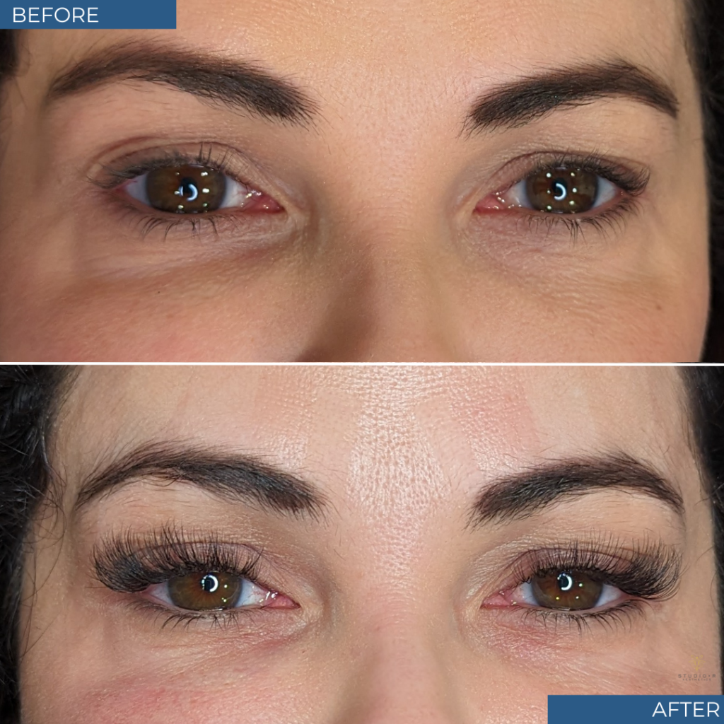 Esthetician Services Before & After