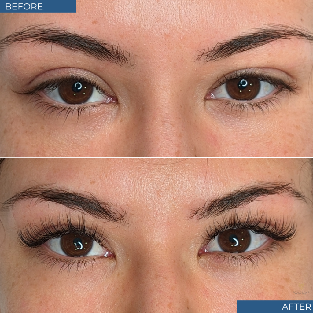 Esthetician Services Before & After